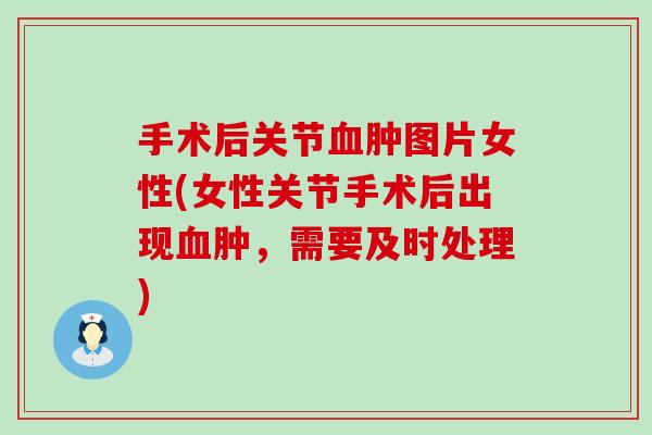 手术后关节血肿图片女性(女性关节手术后出现血肿,需要及时处理)-第1张图片-氨糖科普网 手术后关节血肿图片女性(女性关节手术后出现血肿,需要及时处理)-第1张图片-氨糖科普网