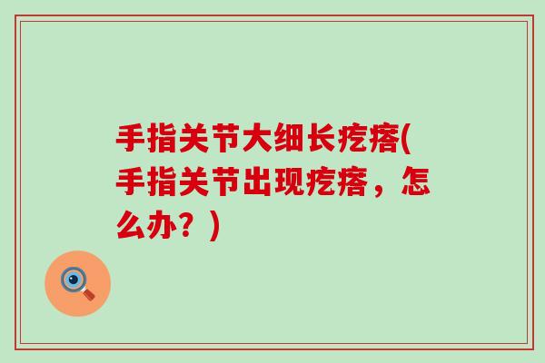 手指关节大细长疙瘩(手指关节出现疙瘩,怎么办?)-第1张图片-氨糖科普网 手指关节大细长疙瘩(手指关节出现疙瘩,怎么办?)-第1张图片-氨糖科普网