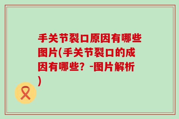 手关节裂口原因有哪些图片(手关节裂口的成因有哪些？-图片解析)-第1张图片-氨糖科普网