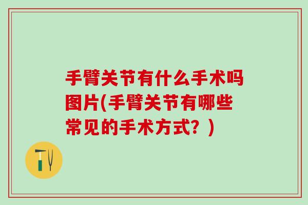 手臂关节有什么手术吗图片(手臂关节有哪些常见的手术方式?)-第1张图片-氨糖科普网 手臂关节有什么手术吗图片(手臂关节有哪些常见的手术方式?)-第1张图片-氨糖科普网