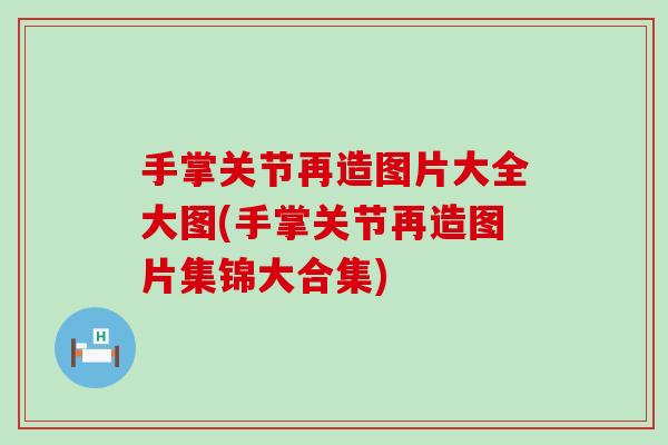 手掌关节再造图片大全大图(手掌关节再造图片集锦大合集)-第1张图片-氨糖科普网 手掌关节再造图片大全大图(手掌关节再造图片集锦大合集)-第1张图片-氨糖科普网
