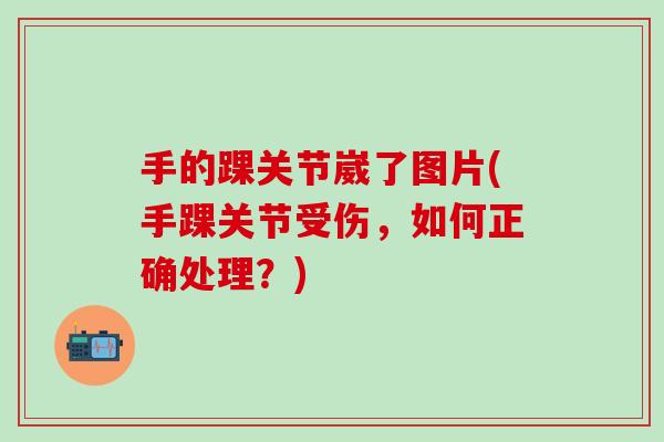 手的踝关节崴了图片(手踝关节受伤,如何正确处理?)-第1张图片-氨糖科普网 手的踝关节崴了图片(手踝关节受伤,如何正确处理?)-第1张图片-氨糖科普网