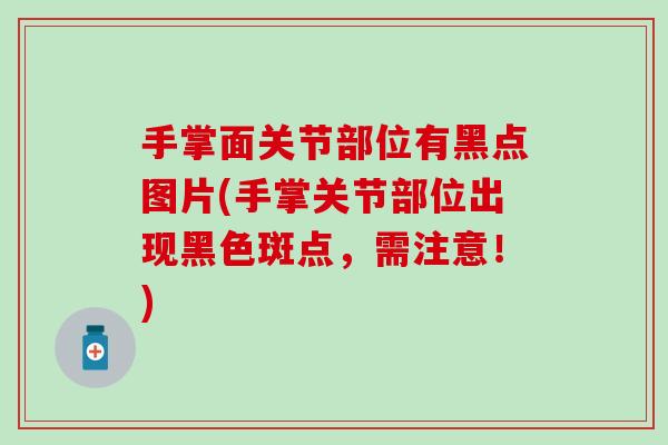 手掌面关节部位有黑点图片(手掌关节部位出现黑色斑点,需注意!)-第1张图片-氨糖科普网 手掌面关节部位有黑点图片(手掌关节部位出现黑色斑点,需注意!)-第1张图片-氨糖科普网