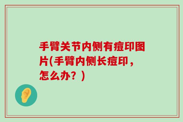 手臂关节内侧有痘印图片(手臂内侧长痘印，怎么办？)-第1张图片-氨糖科普网