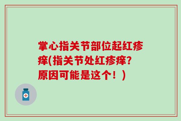掌心指关节部位起红疹痒(指关节处红疹痒？原因可能是这个！)-第1张图片-氨糖科普网