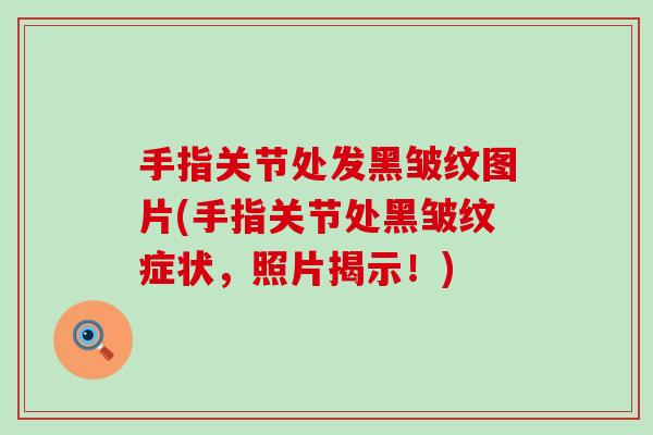 手指关节处发黑皱纹图片(手指关节处黑皱纹症状,照片揭示!)-第1张图片-氨糖科普网 手指关节处发黑皱纹图片(手指关节处黑皱纹症状,照片揭示!)-第1张图片-氨糖科普网