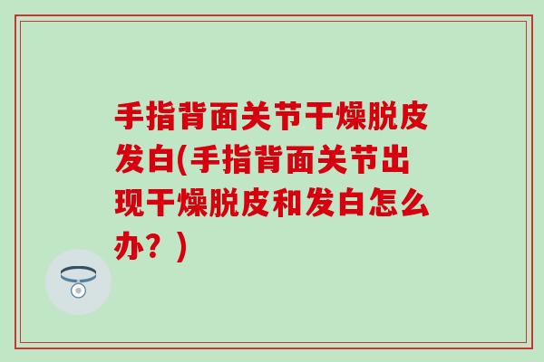 手指背面关节干燥脱皮发白(手指背面关节出现干燥脱皮和发白怎么办?)-第1张图片-氨糖科普网 手指背面关节干燥脱皮发白(手指背面关节出现干燥脱皮和发白怎么办?)-第1张图片-氨糖科普网