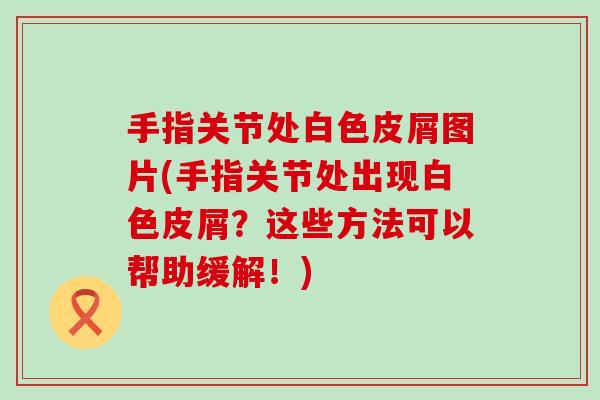手指关节处白色皮屑图片(手指关节处出现白色皮屑?这些方法可以帮助缓解!)-第1张图片-氨糖科普网 手指关节处白色皮屑图片(手指关节处出现白色皮屑?这些方法可以帮助缓解!)-第1张图片-氨糖科普网