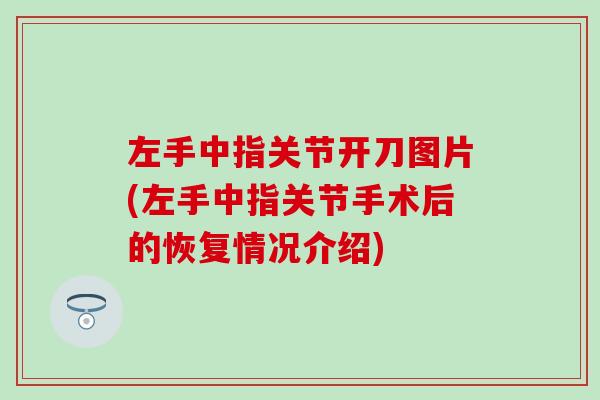 左手中指关节开刀图片(左手中指关节手术后的恢复情况介绍)-第1张图片-氨糖科普网 左手中指关节开刀图片(左手中指关节手术后的恢复情况介绍)-第1张图片-氨糖科普网