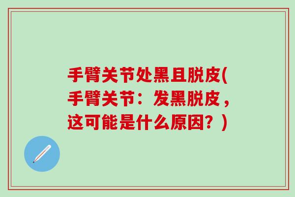 手臂关节处黑且脱皮(手臂关节:发黑脱皮,这可能是什么原因?)-第1张图片-氨糖科普网 手臂关节处黑且脱皮(手臂关节:发黑脱皮,这可能是什么原因?)-第1张图片-氨糖科普网