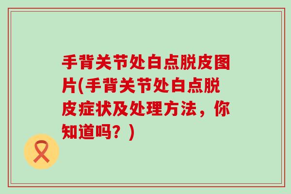 手背关节处白点脱皮图片(手背关节处白点脱皮症状及处理方法,你知道吗?)-第1张图片-氨糖科普网 手背关节处白点脱皮图片(手背关节处白点脱皮症状及处理方法,你知道吗?)-第1张图片-氨糖科普网
