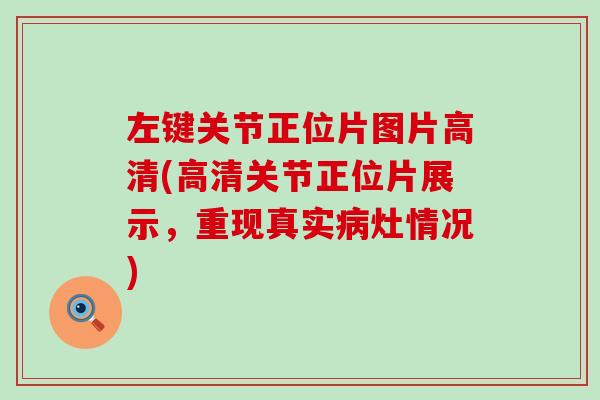 左键关节正位片图片高清(高清关节正位片展示,重现真实病灶情况)-第1张图片-氨糖科普网 左键关节正位片图片高清(高清关节正位片展示,重现真实病灶情况)-第1张图片-氨糖科普网