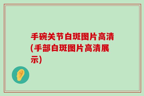 手碗关节白斑图片高清(手部白斑图片高清展示)-第1张图片-氨糖科普网 手碗关节白斑图片高清(手部白斑图片高清展示)-第1张图片-氨糖科普网