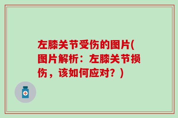 左膝关节受伤的图片(图片解析：左膝关节损伤，该如何应对？)-第1张图片-氨糖科普网