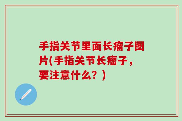 手指关节里面长瘤子图片(手指关节长瘤子,要注意什么?)-第1张图片-氨糖科普网 手指关节里面长瘤子图片(手指关节长瘤子,要注意什么?)-第1张图片-氨糖科普网