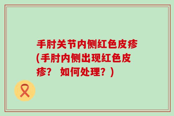 手肘关节内侧红色皮疹(手肘内侧出现红色皮疹？ 如何处理？)-第1张图片-氨糖科普网