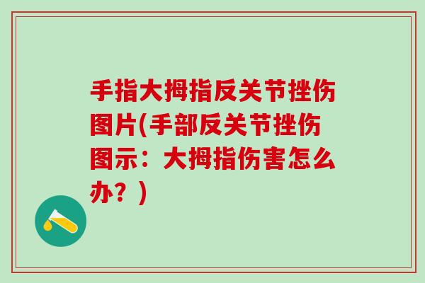 手指大拇指反关节挫伤图片(手部反关节挫伤图示:大拇指伤害怎么办?)-第1张图片-氨糖科普网 手指大拇指反关节挫伤图片(手部反关节挫伤图示:大拇指伤害怎么办?)-第1张图片-氨糖科普网
