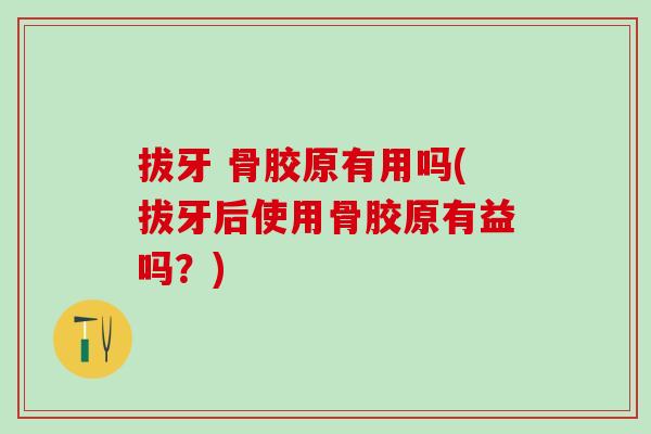 拔牙 骨胶原有用吗(拔牙后使用骨胶原有益吗?)-第1张图片-氨糖科普网 拔牙 骨胶原有用吗(拔牙后使用骨胶原有益吗?)-第1张图片-氨糖科普网