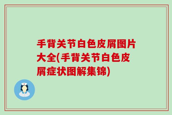 手背关节白色皮屑图片大全(手背关节白色皮屑症状图解集锦)-第1张图片-氨糖科普网 手背关节白色皮屑图片大全(手背关节白色皮屑症状图解集锦)-第1张图片-氨糖科普网