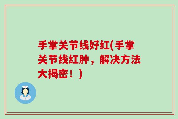 手掌关节线好红(手掌关节线红肿,解决方法大揭密!)-第1张图片-氨糖科普网 手掌关节线好红(手掌关节线红肿,解决方法大揭密!)-第1张图片-氨糖科普网