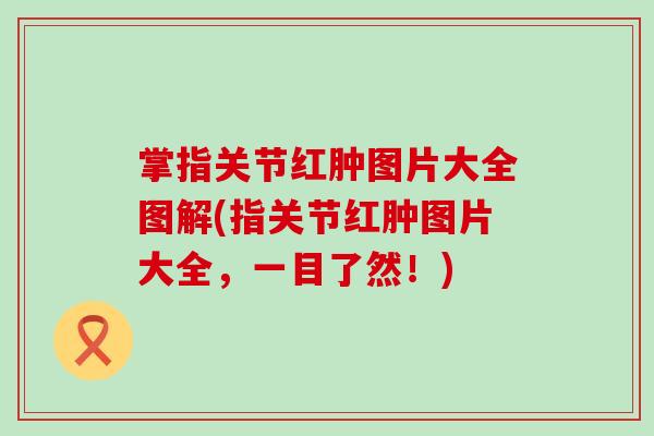 掌指关节红肿图片大全图解(指关节红肿图片大全,一目了然!)-第1张图片-氨糖科普网 掌指关节红肿图片大全图解(指关节红肿图片大全,一目了然!)-第1张图片-氨糖科普网