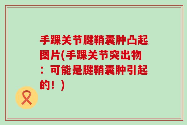 手踝关节腱鞘囊肿凸起图片(手踝关节突出物：可能是腱鞘囊肿引起的！)-第1张图片-氨糖科普网