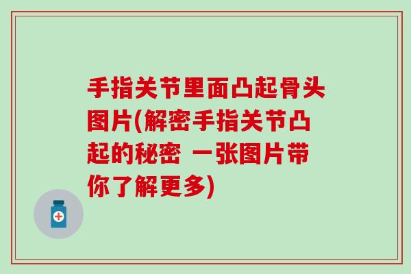 手指关节里面凸起骨头图片(解密手指关节凸起的秘密 一张图片带你了解更多)-第1张图片-氨糖科普网 手指关节里面凸起骨头图片(解密手指关节凸起的秘密 一张图片带你了解更多)-第1张图片-氨糖科普网