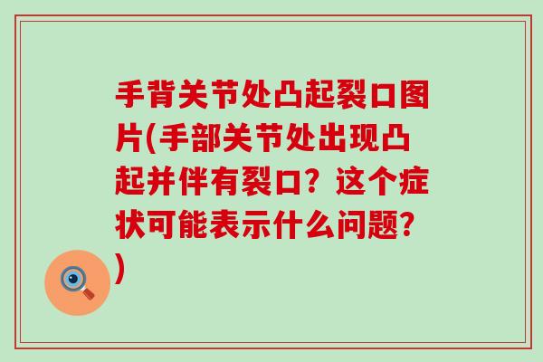 手背关节处凸起裂口图片(手部关节处出现凸起并伴有裂口?这个症状可能表示什么问题?)-第1张图片-氨糖科普网 手背关节处凸起裂口图片(手部关节处出现凸起并伴有裂口?这个症状可能表示什么问题?)-第1张图片-氨糖科普网