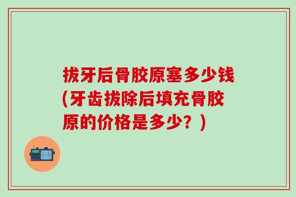 拔牙后骨胶原塞多少钱(牙齿拔除后填充骨胶原的价格是多少？)-第1张图片-氨糖科普网