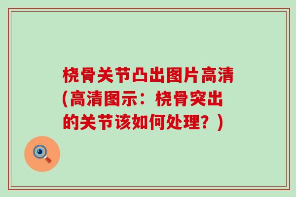 桡骨关节凸出图片高清(高清图示:桡骨突出的关节该如何处理?)-第1张图片-氨糖科普网 桡骨关节凸出图片高清(高清图示:桡骨突出的关节该如何处理?)-第1张图片-氨糖科普网
