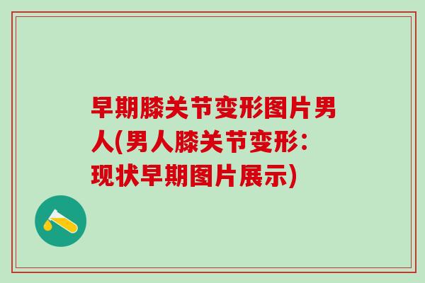 早期膝关节变形图片男人(男人膝关节变形:现状早期图片展示)-第1张图片-氨糖科普网 早期膝关节变形图片男人(男人膝关节变形:现状早期图片展示)-第1张图片-氨糖科普网