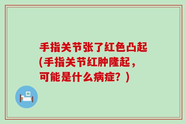 手指关节张了红色凸起(手指关节红肿隆起,可能是什么病症?)-第1张图片-氨糖科普网 手指关节张了红色凸起(手指关节红肿隆起,可能是什么病症?)-第1张图片-氨糖科普网