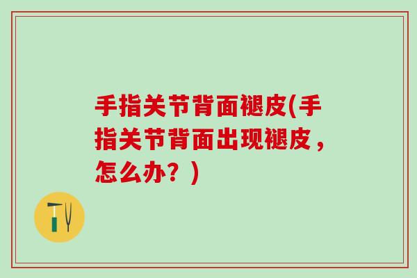手指关节背面褪皮(手指关节背面出现褪皮,怎么办?)-第1张图片-氨糖科普网 手指关节背面褪皮(手指关节背面出现褪皮,怎么办?)-第1张图片-氨糖科普网