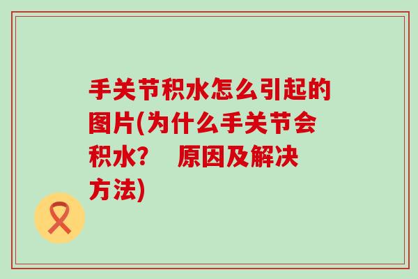 手关节积水怎么引起的图片(为什么手关节会积水? 原因及解决方法)-第1张图片-氨糖科普网 手关节积水怎么引起的图片(为什么手关节会积水? 原因及解决方法)-第1张图片-氨糖科普网