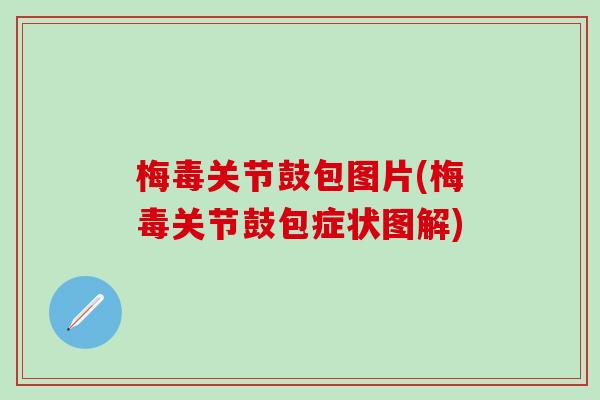 梅毒关节鼓包图片(梅毒关节鼓包症状图解)-第1张图片-氨糖科普网 梅毒关节鼓包图片(梅毒关节鼓包症状图解)-第1张图片-氨糖科普网
