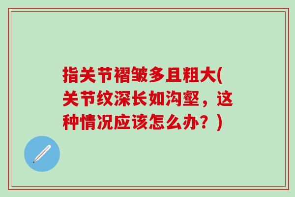 指关节褶皱多且粗大(关节纹深长如沟壑,这种情况应该怎么办?)-第1张图片-氨糖科普网 指关节褶皱多且粗大(关节纹深长如沟壑,这种情况应该怎么办?)-第1张图片-氨糖科普网