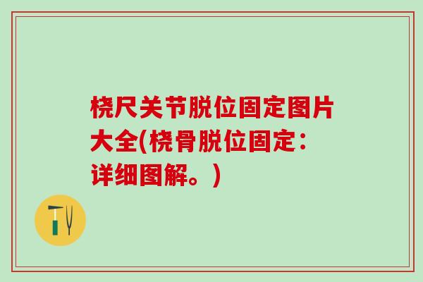 桡尺关节脱位固定图片大全(桡骨脱位固定:详细图解。)-第1张图片-氨糖科普网 桡尺关节脱位固定图片大全(桡骨脱位固定:详细图解。)-第1张图片-氨糖科普网