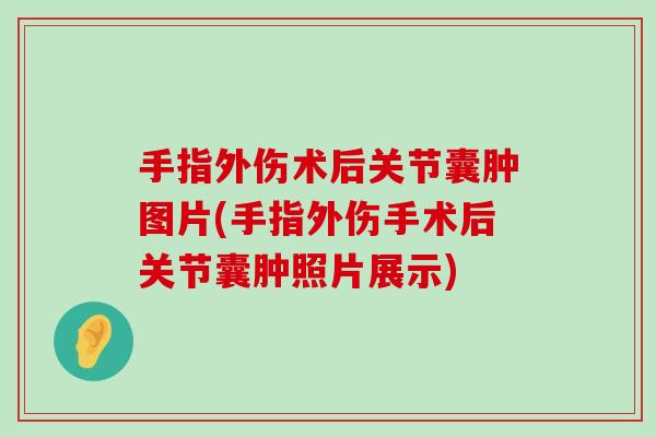 手指外伤术后关节囊肿图片(手指外伤手术后关节囊肿照片展示)-第1张图片-氨糖科普网 手指外伤术后关节囊肿图片(手指外伤手术后关节囊肿照片展示)-第1张图片-氨糖科普网