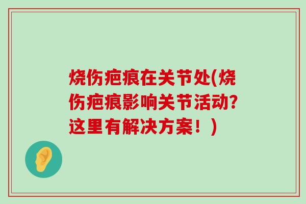 烧伤疤痕在关节处(烧伤疤痕影响关节活动？这里有解决方案！)-第1张图片-氨糖科普网