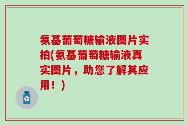 氨基葡萄糖输液图片实拍(氨基葡萄糖输液真实图片,助您了解其应用!)-第1张图片-氨糖科普网 氨基葡萄糖输液图片实拍(氨基葡萄糖输液真实图片,助您了解其应用!)-第1张图片-氨糖科普网