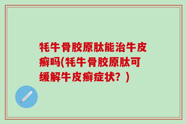 牦牛骨胶原肽能治牛皮癣吗(牦牛骨胶原肽可缓解牛皮癣症状？)-第1张图片-氨糖科普网