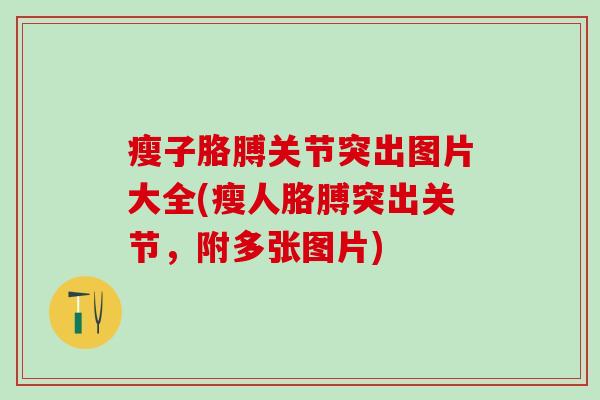 瘦子胳膊关节突出图片大全(瘦人胳膊突出关节,附多张图片)-第1张图片-氨糖科普网 瘦子胳膊关节突出图片大全(瘦人胳膊突出关节,附多张图片)-第1张图片-氨糖科普网