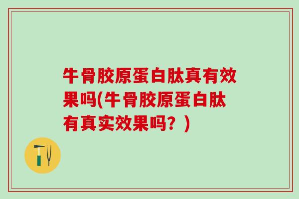 牛骨胶原蛋白肽真有效果吗(牛骨胶原蛋白肽有真实效果吗?)-第1张图片-氨糖科普网 牛骨胶原蛋白肽真有效果吗(牛骨胶原蛋白肽有真实效果吗?)-第1张图片-氨糖科普网