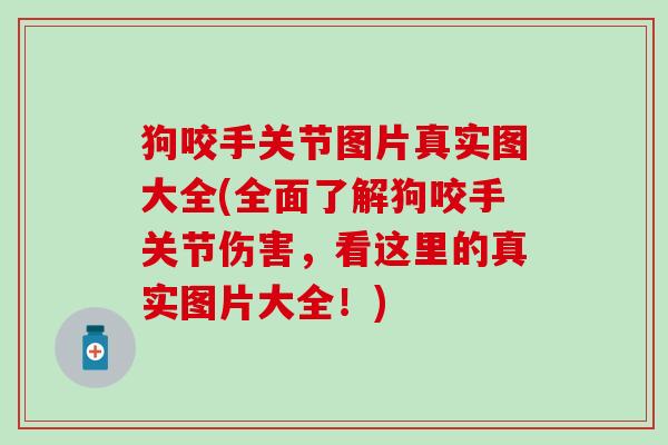 狗咬手关节图片真实图大全(全面了解狗咬手关节伤害,看这里的真实图片大全!)-第1张图片-氨糖科普网 狗咬手关节图片真实图大全(全面了解狗咬手关节伤害,看这里的真实图片大全!)-第1张图片-氨糖科普网