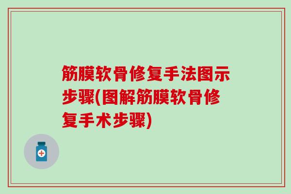 筋膜软骨修复手法图示步骤(图解筋膜软骨修复手术步骤)-第1张图片-氨糖科普网 筋膜软骨修复手法图示步骤(图解筋膜软骨修复手术步骤)-第1张图片-氨糖科普网