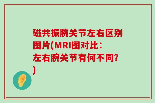 磁共振腕关节左右区别图片(MRI图对比:左右腕关节有何不同?)-第1张图片-氨糖科普网 磁共振腕关节左右区别图片(MRI图对比:左右腕关节有何不同?)-第1张图片-氨糖科普网