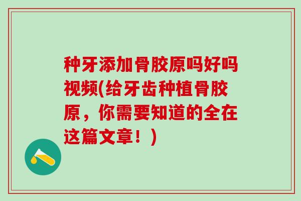种牙添加骨胶原吗好吗视频(给牙齿种植骨胶原,你需要知道的全在这篇文章!)-第1张图片-氨糖科普网 种牙添加骨胶原吗好吗视频(给牙齿种植骨胶原,你需要知道的全在这篇文章!)-第1张图片-氨糖科普网