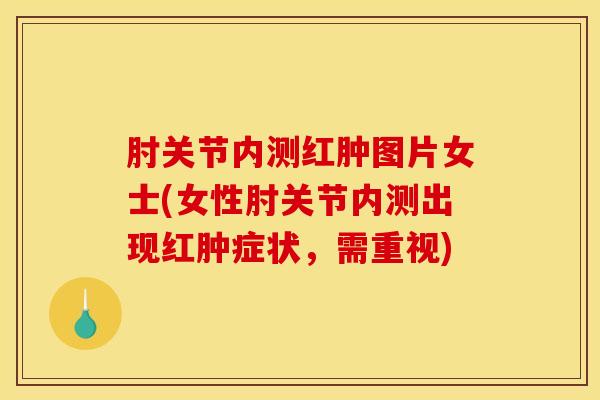 肘关节内测红肿图片女士(女性肘关节内测出现红肿症状,需重视)-第1张图片-氨糖科普网 肘关节内测红肿图片女士(女性肘关节内测出现红肿症状,需重视)-第1张图片-氨糖科普网