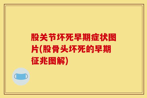 股关节坏死早期症状图片(股骨头坏死的早期征兆图解)-第1张图片-氨糖科普网 股关节坏死早期症状图片(股骨头坏死的早期征兆图解)-第1张图片-氨糖科普网