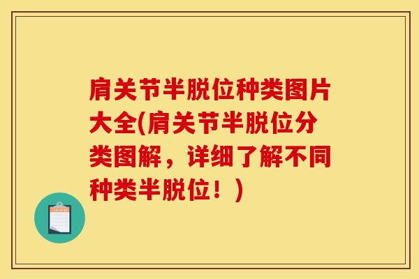 肩关节半脱位种类图片大全(肩关节半脱位分类图解,详细了解不同种类半脱位!)-第1张图片-氨糖科普网 肩关节半脱位种类图片大全(肩关节半脱位分类图解,详细了解不同种类半脱位!)-第1张图片-氨糖科普网